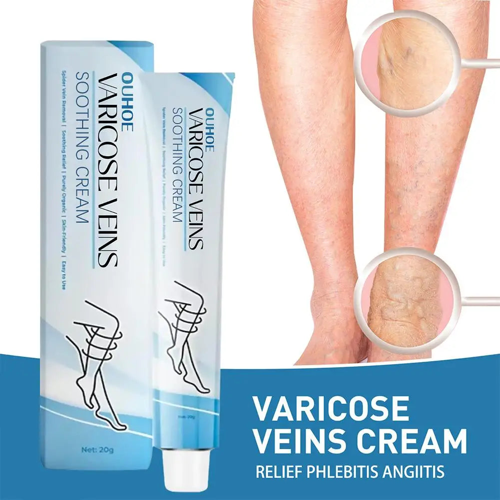 Varicose Veins Cream