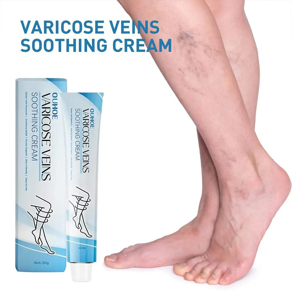 Varicose Veins Cream