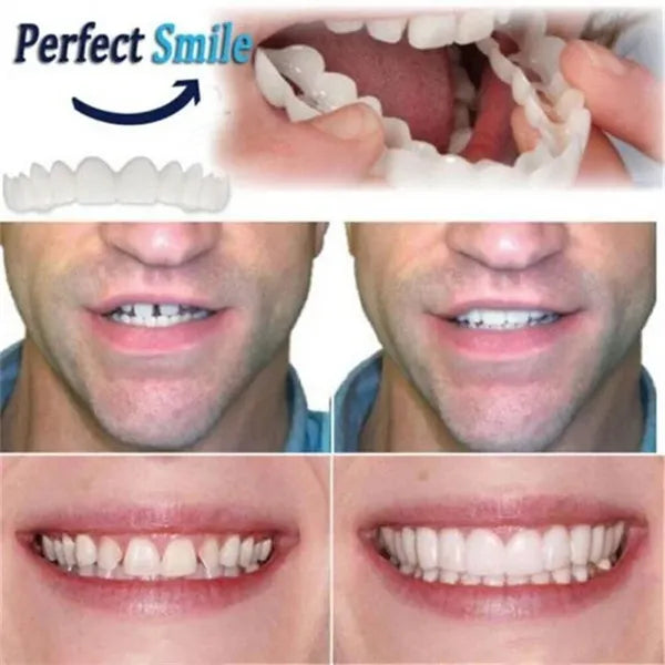 🔥LAST DAY-50%OFF🔥 ADJUSTABLE SNAP-ON DENTURES