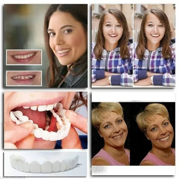 🔥LAST DAY-50%OFF🔥 ADJUSTABLE SNAP-ON DENTURES